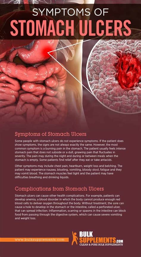 Stomach Ulcers: Causes, Symptoms, Home Remedies & Treatment