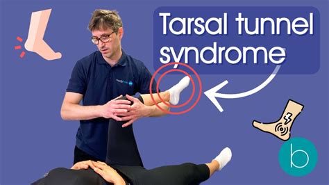 Tarsal Tunnel Syndrome - Everything You Need To Know - YouTube