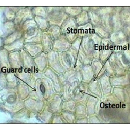 (a) Anomocytic stomata with guard cell. (b) Rosette calcium oxalate ...