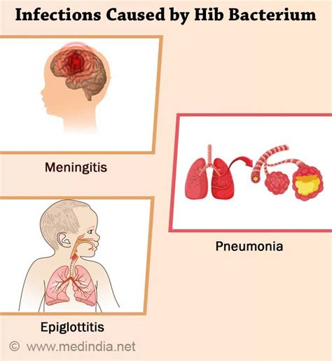 Hib Vaccine - Types, Dosage Schedule, Contraindications and Side Effects