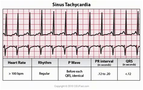 EKG Review - A2 Cardiothoracic Unit