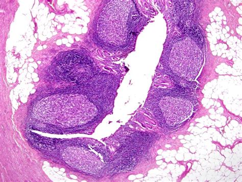 appendix: Prominent lymphatic nodules and tons of goblet cells | Lymphatic nodules, Histology ...