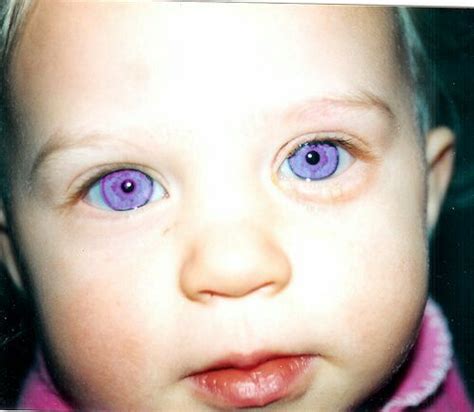 Pin by Lydia Bates on Cute kids | Rare eyes, Violet eyes, Beautiful eyes