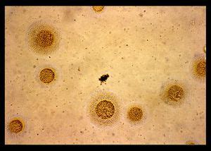 Mycoplasma hominis - microbewiki