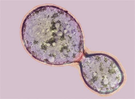 Cryptococcus Cell Dividing, Tem Photograph by London School Of Hygiene ...