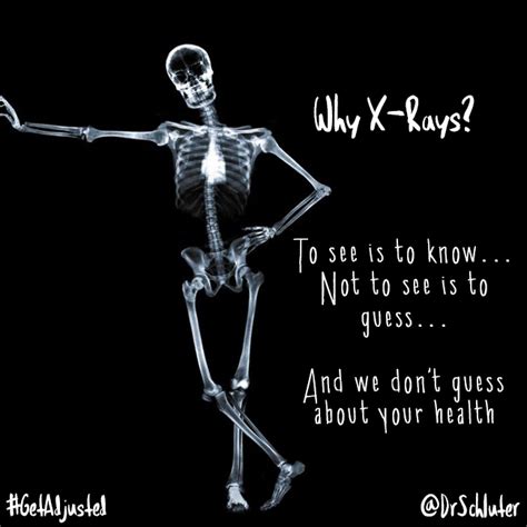 X-Rays: Knowing, Not Guessing | Tulsa Chiropractor - Schluter Chiropractic