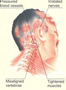 Suffering with Headaches or Migraines? Freehold NJ Chiropractor CAN ...