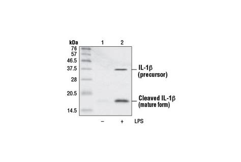 IL-1β Antibody | Cell Signaling Technology