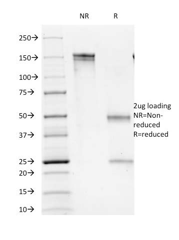 CD16 / FcγReceptor III Antibody - Clone C16/1045 - Gene ID 2214 (Human)