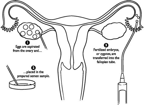 Female Reproductive System Drawing at GetDrawings | Free download