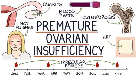 Understanding Early Menopause: Premature Ovarian Insufficiency - YouTube