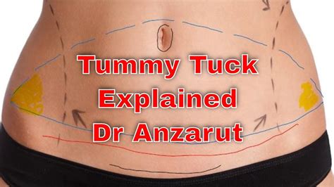 How Tummy Tuck Surgery Helps In Attaining Aesthetic Body Profile - fortbendisdnews