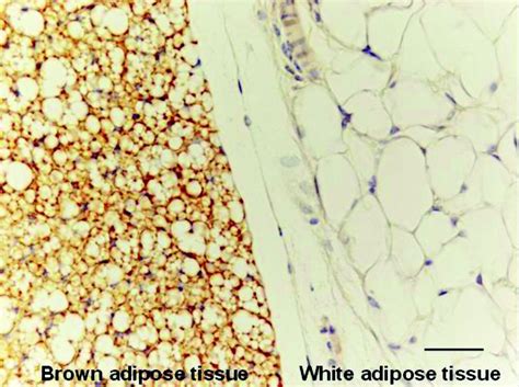 Beta-lapachone activates brown fat cells - Beta-Lapachone.com