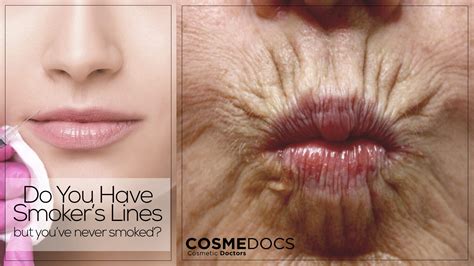 How To Reduce Smokers Lips | Lipstutorial.org