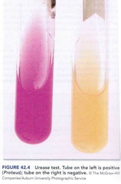 urease test | Microbiology, Microbiology lab, Medical lab technician