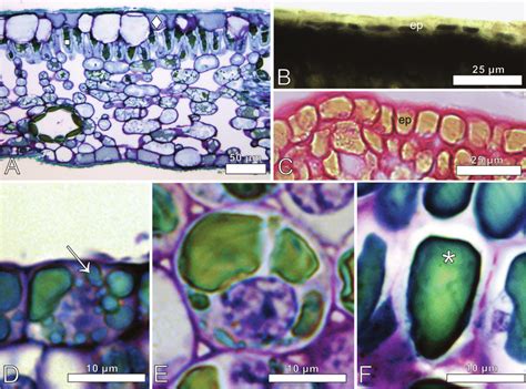 Leaf idioblasts of Myrsine coriacea (B, D, E) and Myrsine venosa (A, C,... | Download Scientific ...