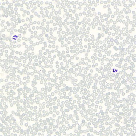 1pcs human blood smear Giemsa Stain, wholesale prepared microscope slides