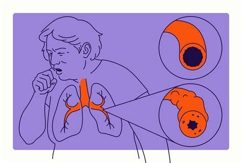 COPD: Types, Symptoms, Causes, Diagnosis, & Treatment