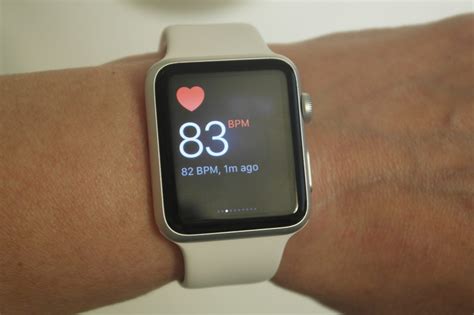 Apple Watch glucose monitoring | Diabetes Daily Forums