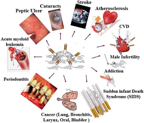 Smoking effects on human with a list of various diseases. | Download Scientific Diagram