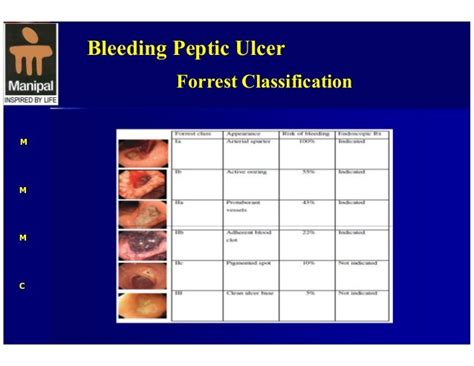 Upper GI Hemorrhage-- Surgical perspective