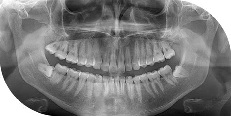 Radiologie dentaire - Centres de soins dentaires - Centre dentaire Nice