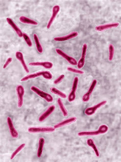 Tetanus - Clostridium tetani - Oxford Sandy and Black Pig Foundation ...