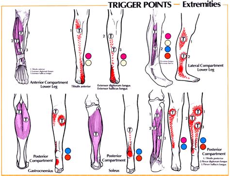 MAKLUMAT KESIHATAN DAN PENYAKIT: Trigger Point Referral Patterns