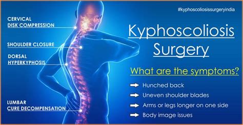 Kyphoscoliosis spine curvature surgery in India | Patient success story | How to memorize things ...