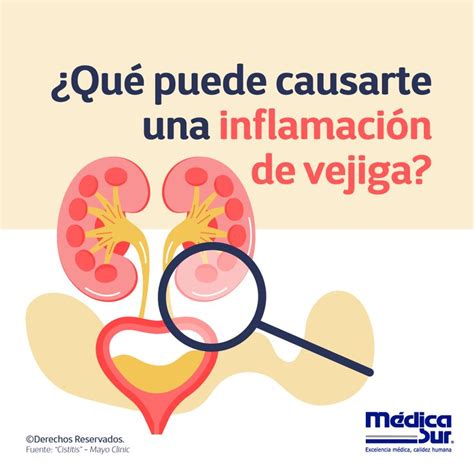 ¿Qué puede causarte una inflamación de vejiga? | Heart sunglass, Nurse