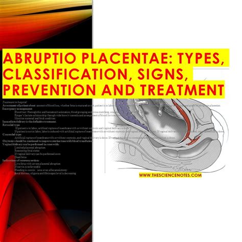 ABRUPTIO PLACENTAE: TYPES, CLASSIFICATION, SIGNS, PREVENTION AND TREATMENT - The Science Notes