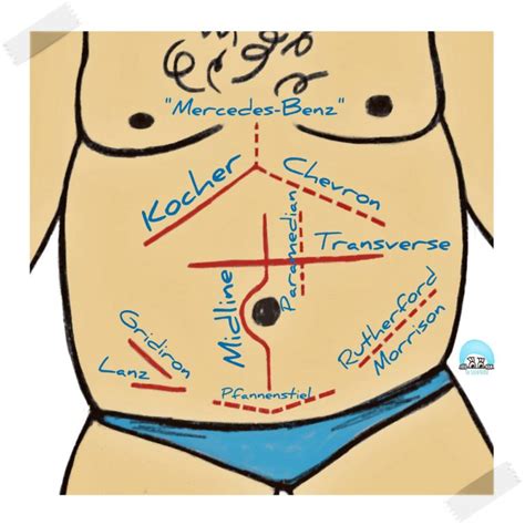 Types of surgery based on urgency - The Scrub Nurse (2023)