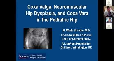 Coxa Valga, Neuromuscular Hip Dysplasia and Coxa Vara in the Pediatric Hip - POSNAcademy