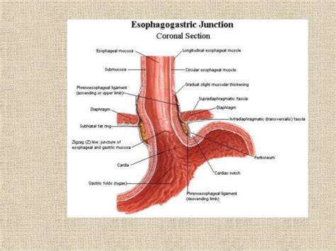 Z Line Esophagus Anatomy - Anatomical Charts & Posters