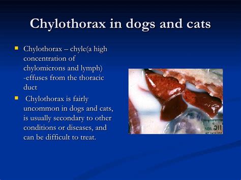 Chylothorax