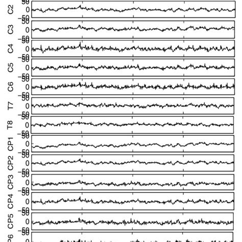 The original EEG signal. | Download Scientific Diagram