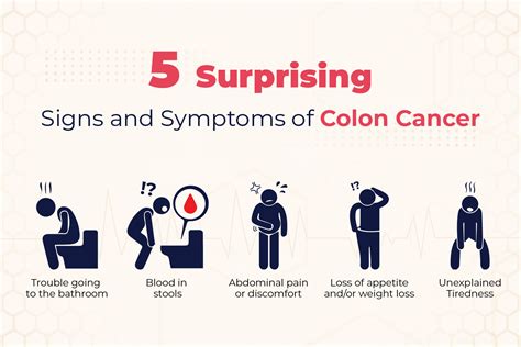 Colon cancer: What are the risk factors, symptoms, prevention, screening, and treatment ...