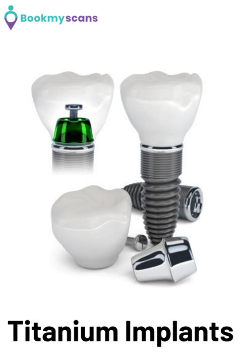 Titanium Implants:-Generally, Titanium is used for bone fractures as well as for Dental Works ...