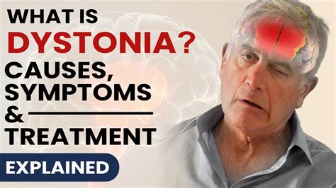 What is Dystonia - Causes , Symptoms & Treatment (Explained) - YouTube