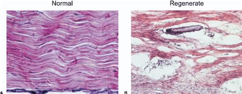 Tendon Vs Ligament Histology