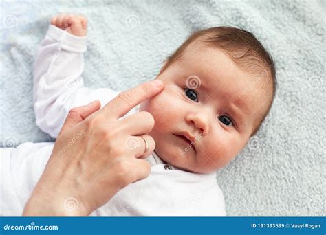 Baby with Atopic Dermatitis Getting Cream Put. Care and Prevention of Eczema Stock Image - Image ...