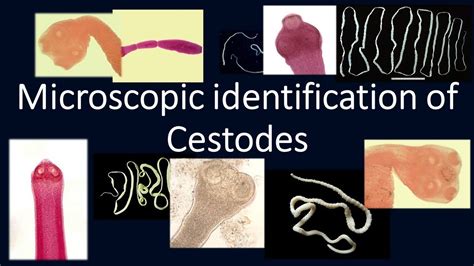 Microscopic identification of Cestodes#Cestodes#MLS#Helminths#Taeniasolium#Taenia#Hymenolepis ...