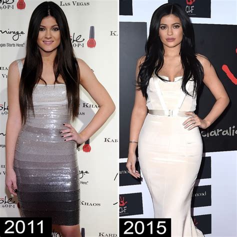 Did Kylie Jenner Get a Boob Job? See Before and After Pics of the Star