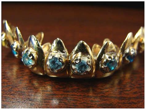 What the Heck are Dental Grillz? | HubPages