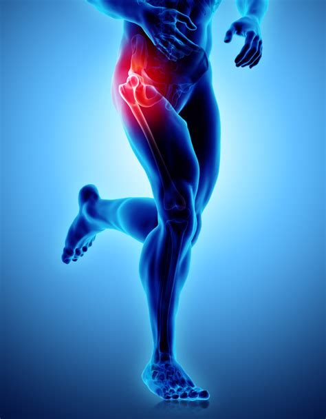 10 Hip Pain Remedies - Center for Spine and Ortho