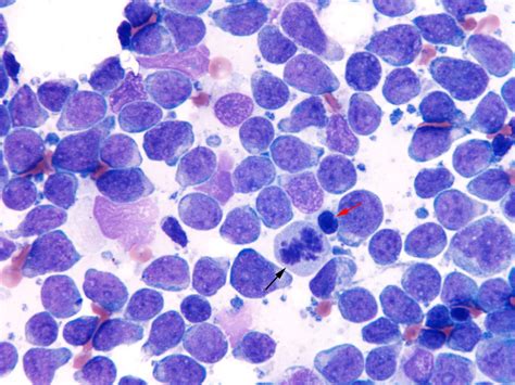 Lymphoma in a dog | eClinpath