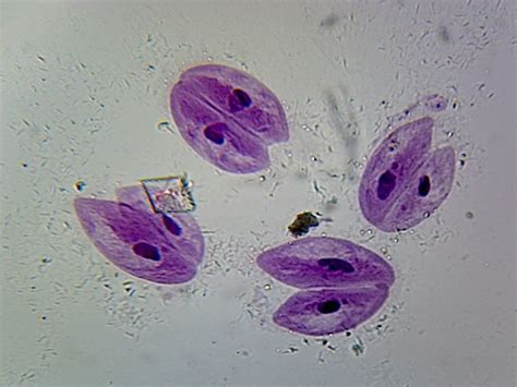 Asexual and sexual reproduction in Paramecium - Online Science Notes