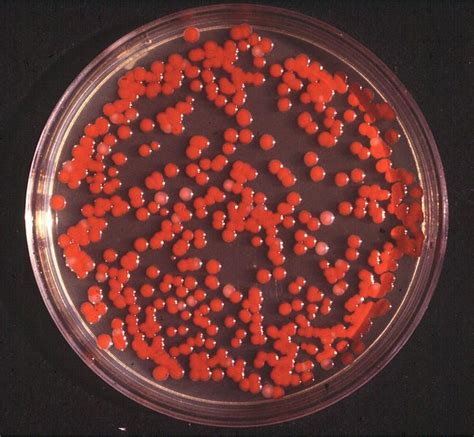 Serratia - wikidoc