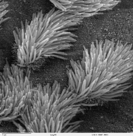 Microvilli vs. Cilia Structures & Sizes | What are Microvilli & Cilia ...