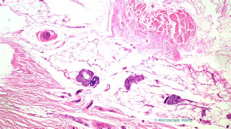 Microscope World Blog: Human Nonpigmented Skin under the Microscope